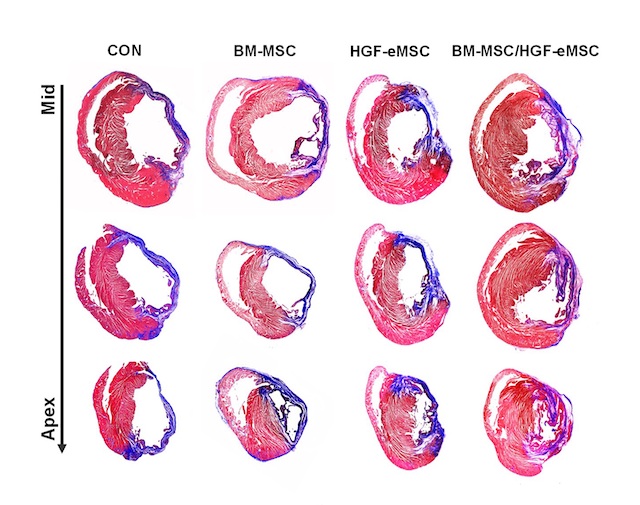 New in vivo priming strategy to train stem cells can enhance cardiac repair effectiveness