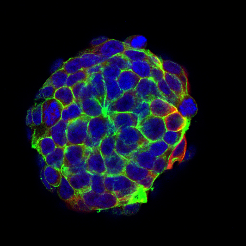 Prostate Spheroid Prostate Spheroid