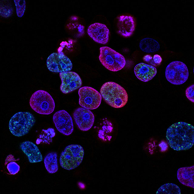 Cancer Biology & Therapy