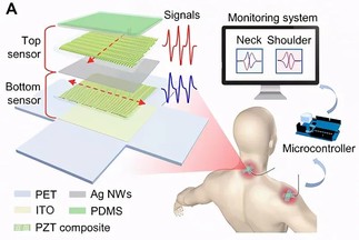 A new sensor and joint motion monitoring system to remind users to exercise regularly