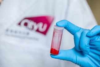 novel photo-oxidation therapy for anticancer treatment