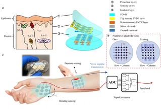 Skin-inspired tactile sensors distinguish diverse stimuli and offer hope for limb injuries