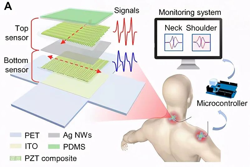 flexible piezoelectric sensor