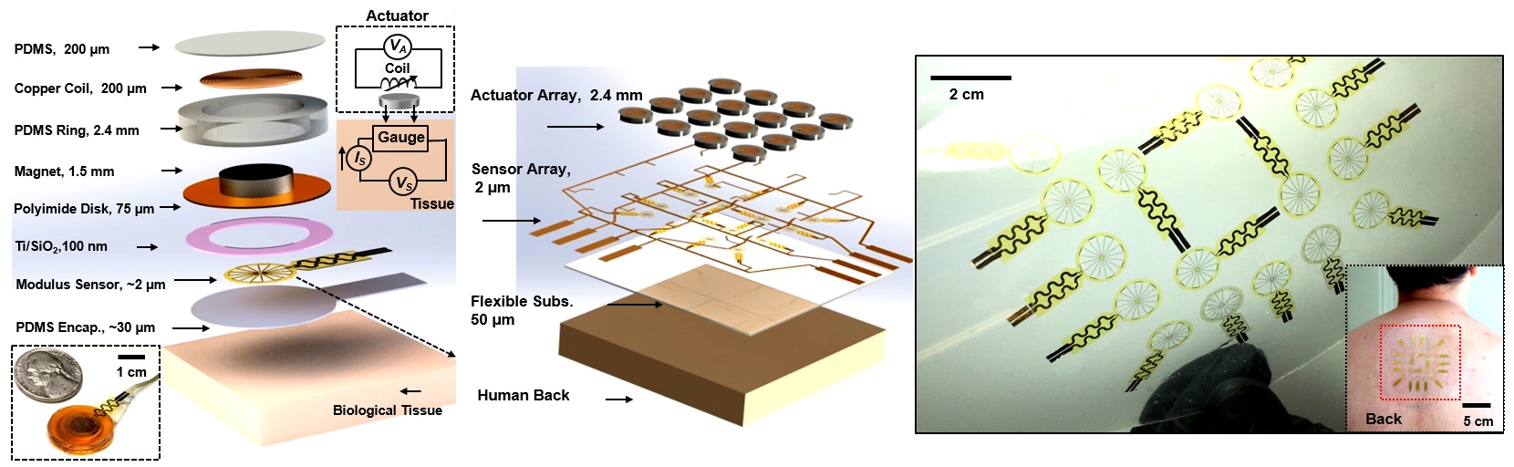 tissue stiffness