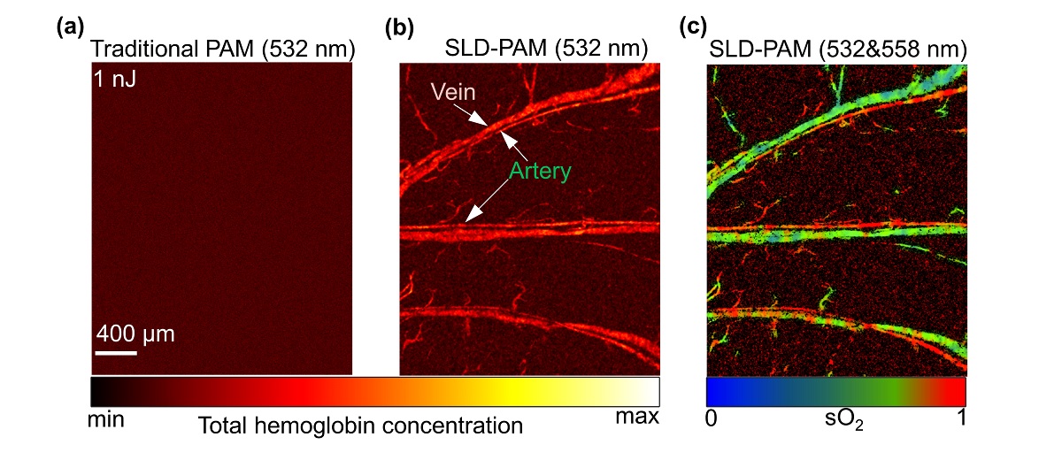 photoacoustic microscopy