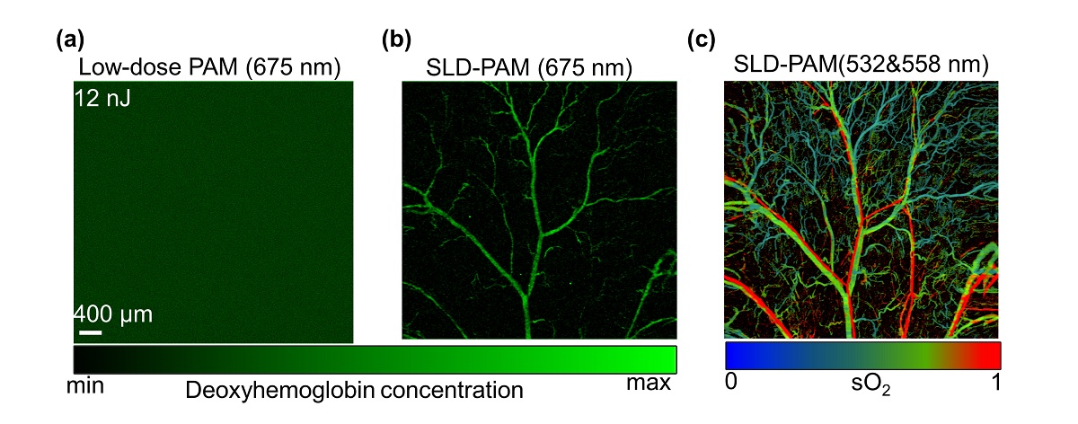 photoacoustic microscopy