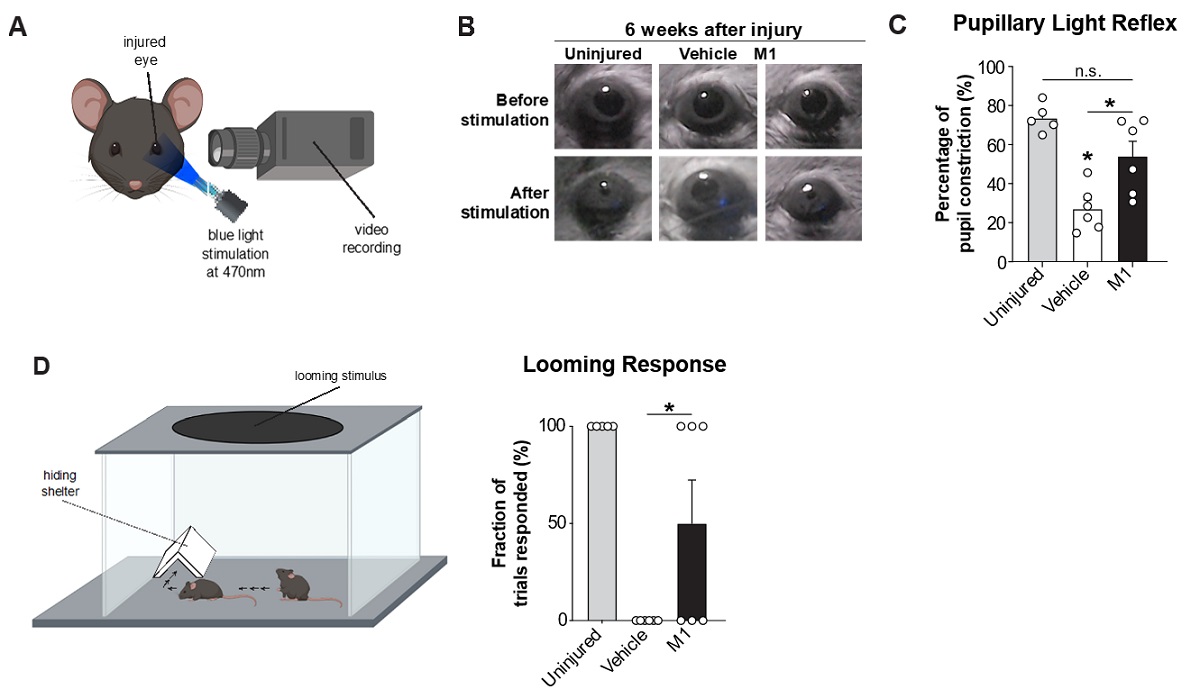 optic nerve injury