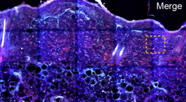 Fluorescent images showing the expression OVA in subcutaneous dendritic cells (CD11c+) 48 hours after μEPO-facilitated transdermal delivery of OVA-DNAs.