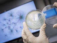 Pseudomonas aeruginosa, a superbug classified as one of the three “critical priority pathogens” that new drugs are urgently needed.