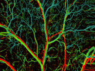 photoacoustic microscopy